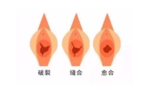 下载.jpg 下载.jpg